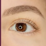 2A.Before_After_Carina_LE_Black_720x